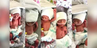 تولد نادر پنجگانگی در افغانستان؛ حال مادر و نوزادان خوب است